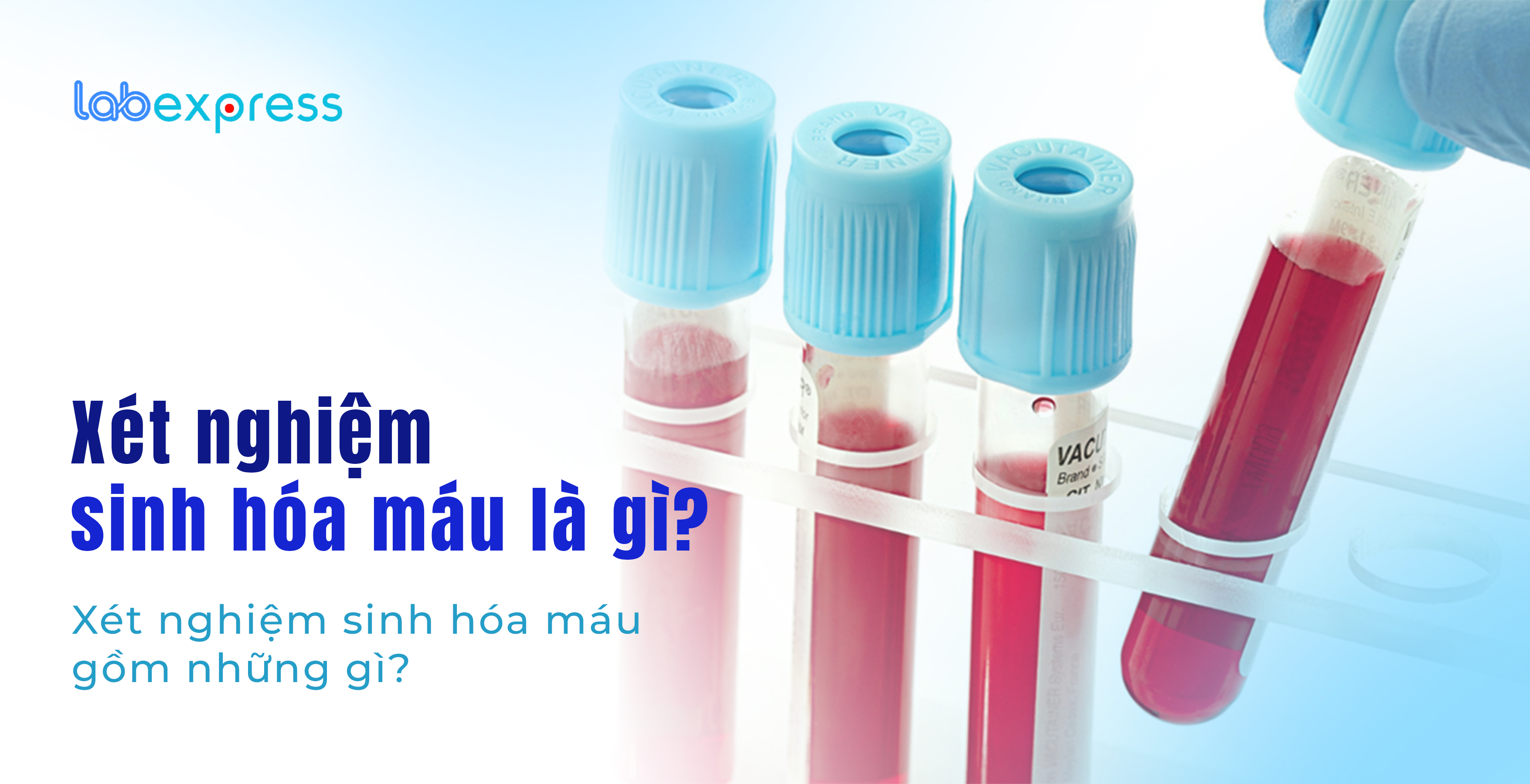 XÉT NGHIỆM SINH HOÁ MÁU LÀ GÌ? XÉT NGHIỆM SINH HOÁ MÁU GỒM NHỮNG GÌ?