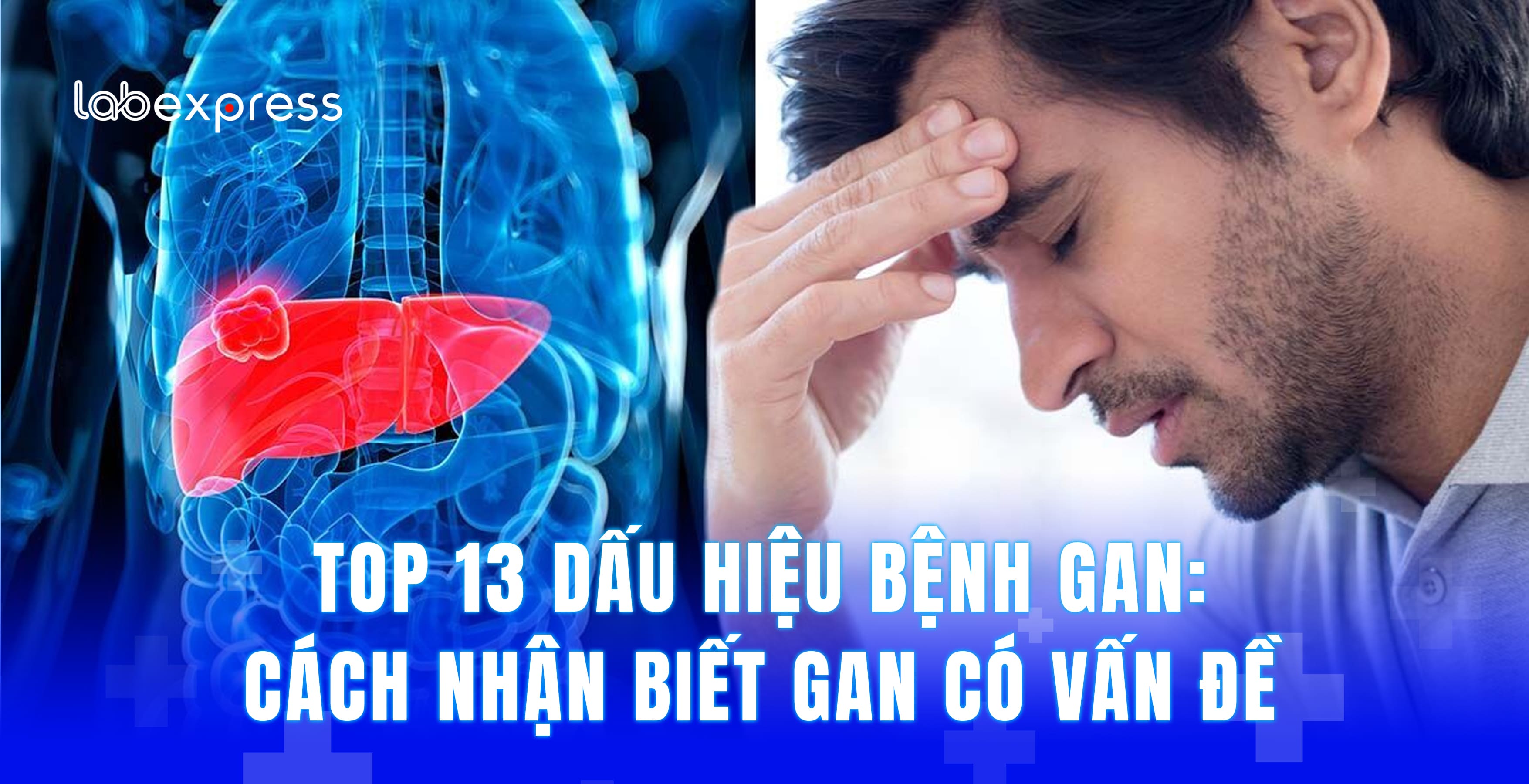 TOP 13 DẤU HIỆU BỆNH GAN: CÁCH NHẬN BIẾT GAN CÓ VẤN ĐỀ