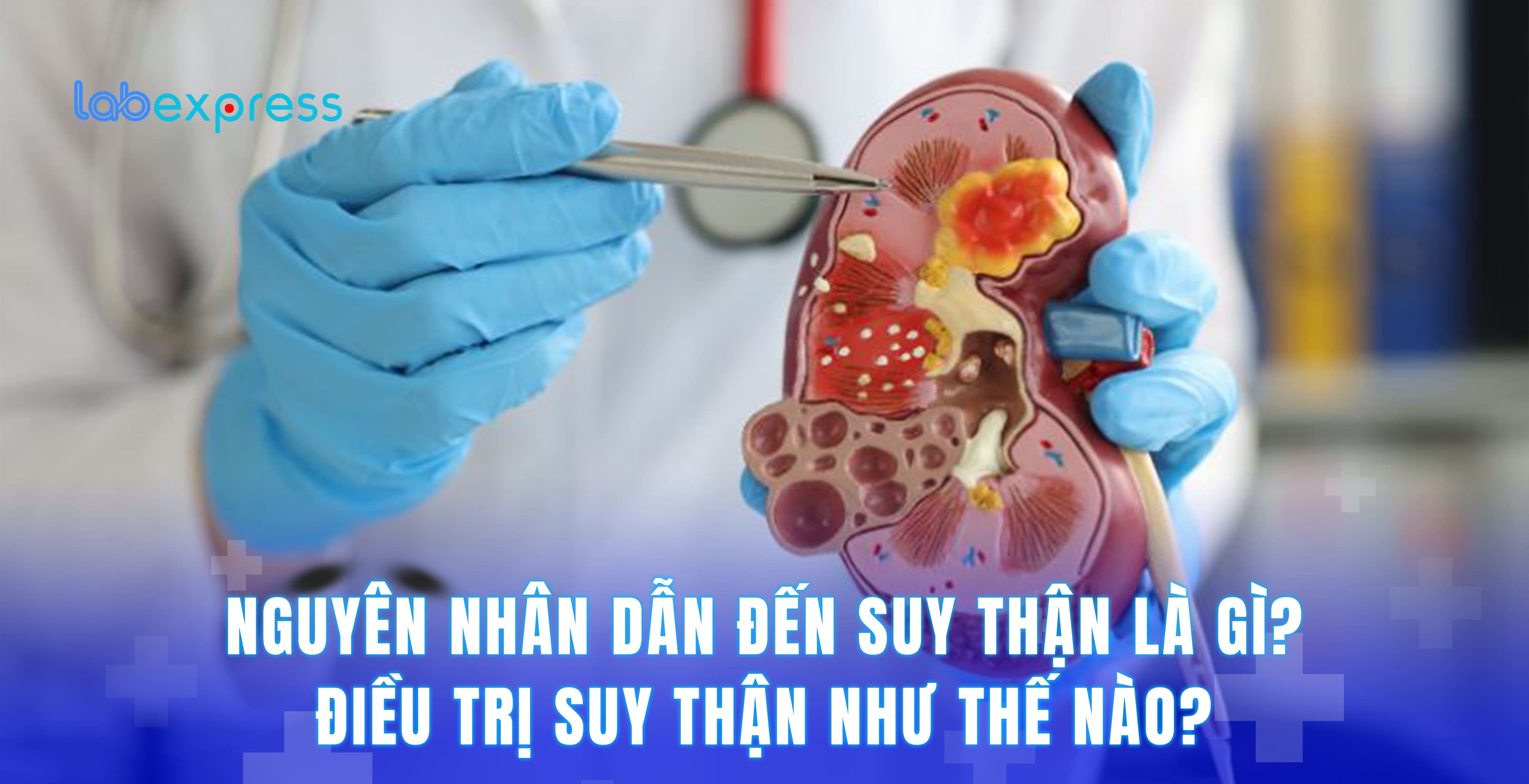 NGUYÊN NHÂN DẪN ĐẾN SUY THẬN LÀ GÌ? ĐIỀU TRỊ SUY THẬN NHƯ THẾ NÀO?