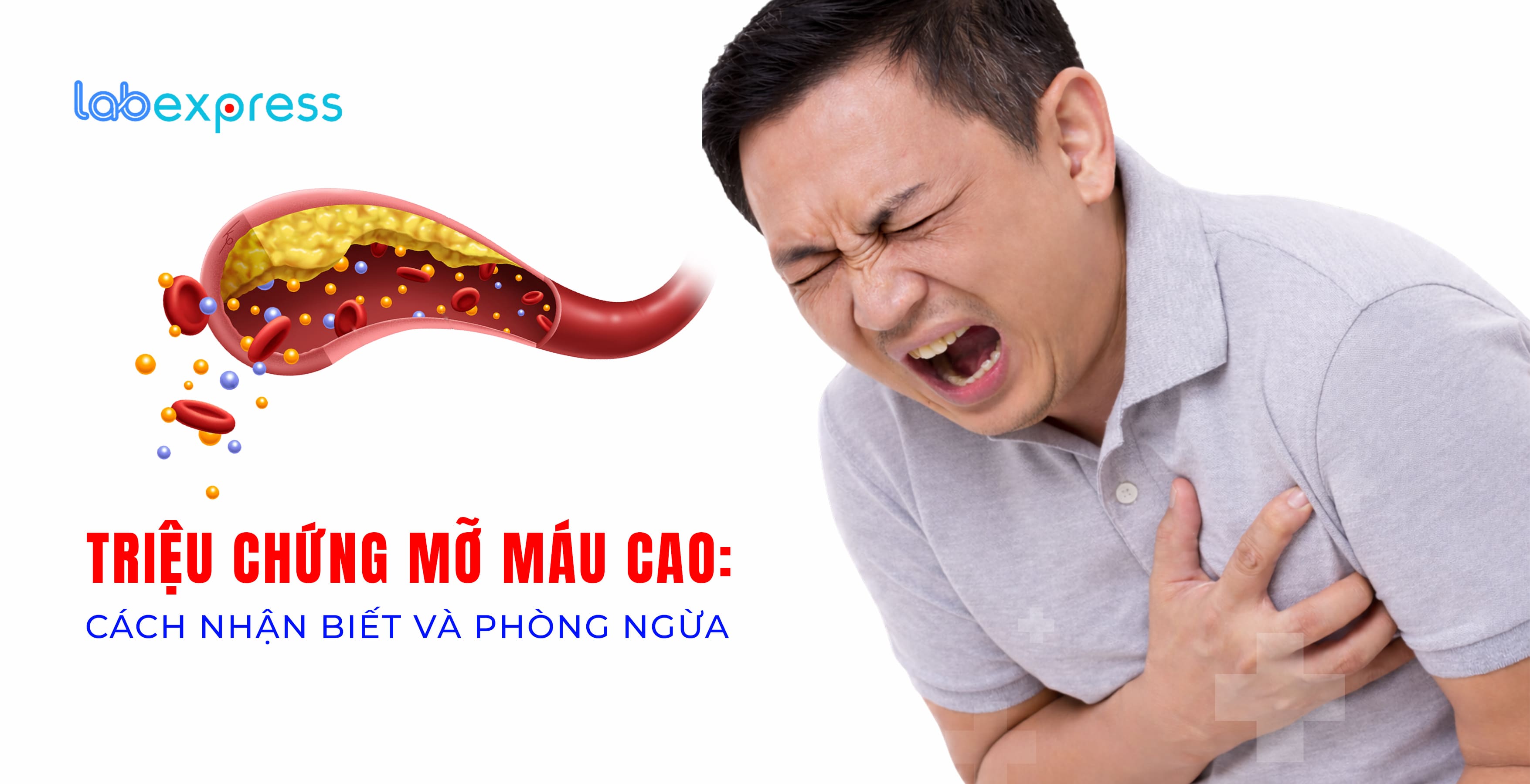 TRIỆU CHỨNG MỠ MÁU CAO: CÁCH NHẬN BIẾT VÀ PHÒNG NGỪA